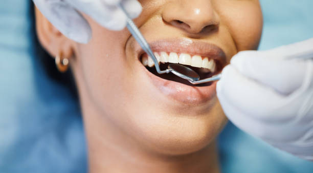 Best Emergency Dental Extractions in Mount Jackson, VA