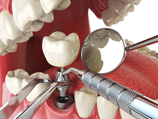 Best Emergency Dental Services for Seniors in Mount Jackson, VA
