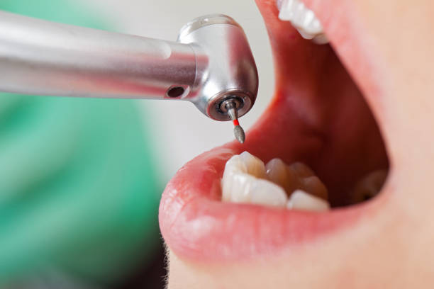 Best Broken or Cracked Tooth Emergency Dentist in Mount Jackson, VA